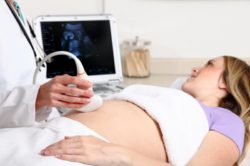 Image of an ultrasound examination
