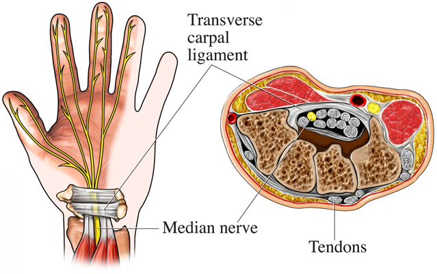 Contrast Medium: Using Gadolinium or Iodine in Patients with Kidney Problems